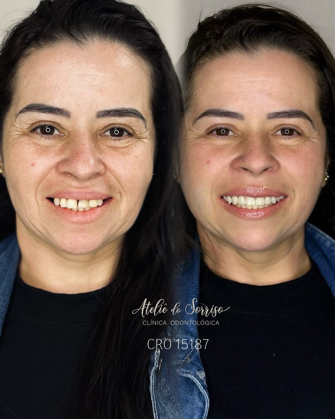 Transformação de Sorriso 12